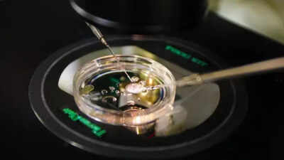 Could your skin hold the key to creating life? Scientists turn human skin cells into eggs in groundbreaking study | Could your skin hold the key to creating life? Scientists turn human skin cells into eggs in groundbreaking study |