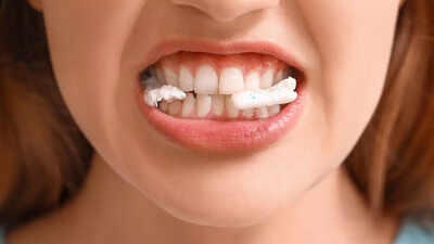 Why the sound of chewing, tapping or clicking drives you mad, according to neuroscience |