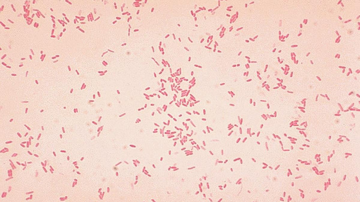 Microbe might spark first stages of ulcerative colitis: new study