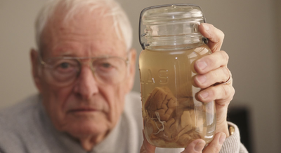 Albert Einstein’s brain was stolen by a doctor and carried around for 40 years |