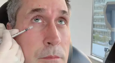 Botox on just one side: Doctor injects half of husband’s face to show ‘shocking’ before-and-after |