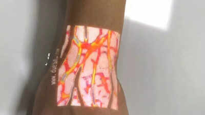 Chinese company builds a device that can ‘see through’ your skin and show your veins instantly |