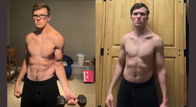 Extreme asymmetry: Doctors warn after influencer spends 300 days training only one shoulder |