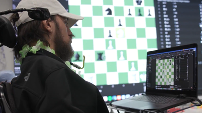 This shouldn’t be real: Paralysed patients play video games just by thinking after Neuralink transplant |