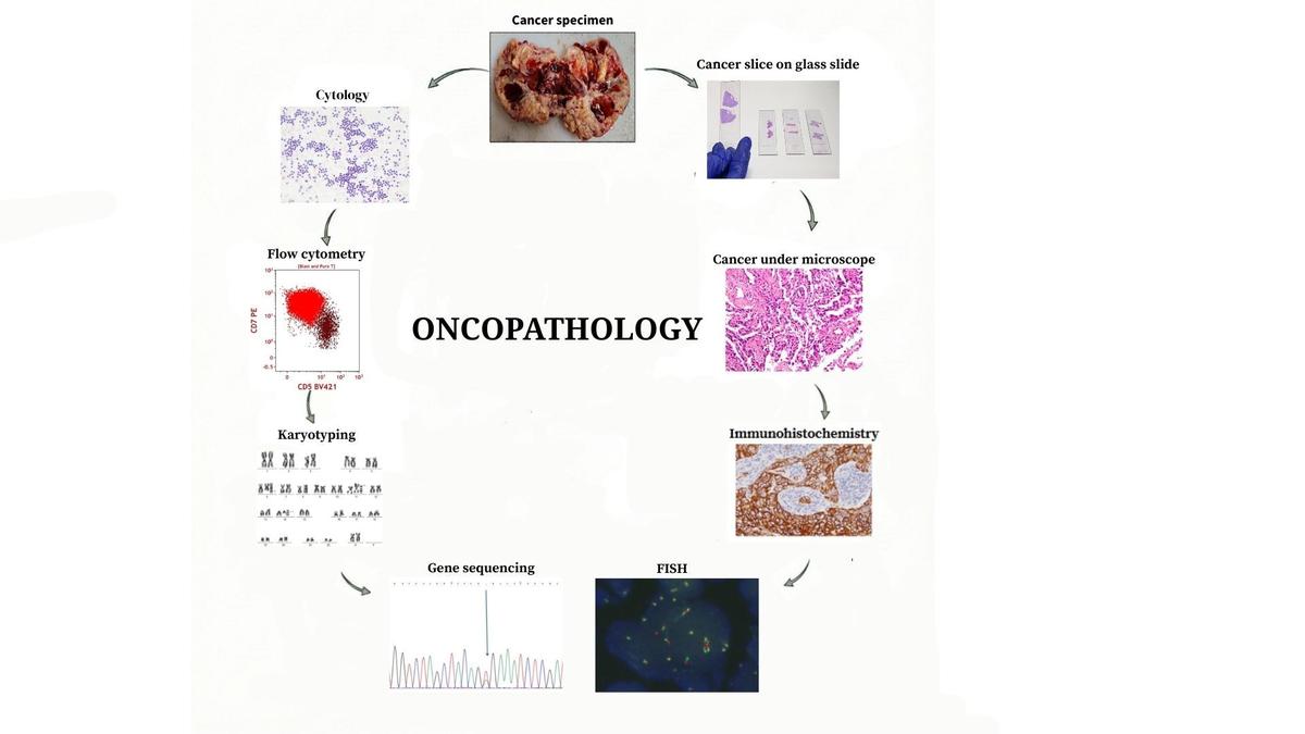 The holy trinity of cancer care: biochemistry, microbiology and pathology