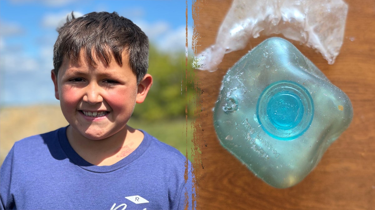 TikTok trend leaves boy with severe burns, doctors issue warning