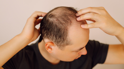 Scientists develop plant-based serum that regrows hair within weeks |